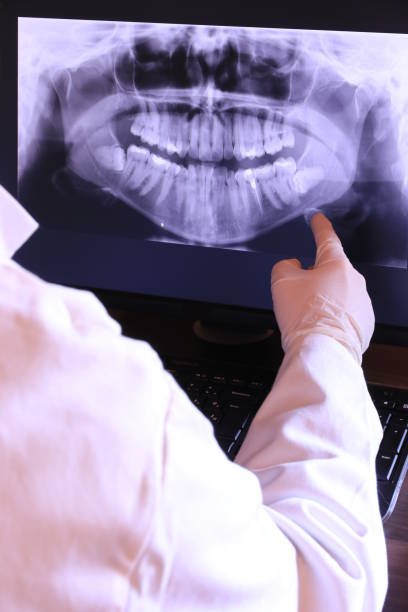 Best Broken or Chipped Tooth Repair in Hazlehurst, GA