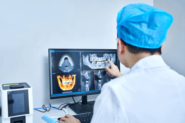 Best Knocked-Out Tooth (Avulsed Tooth) Treatment in Hazlehurst, GA